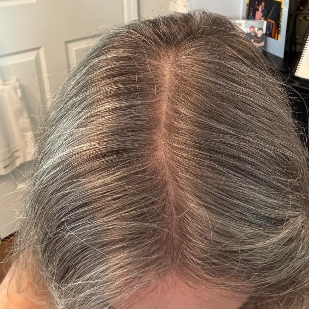 Ella's part line after 20 weeks of use