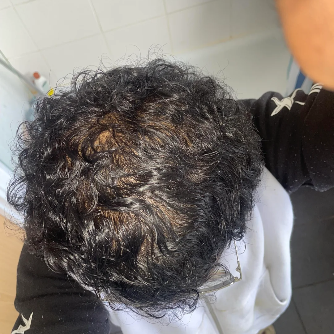 Marcus's crown after 16 weeks of use