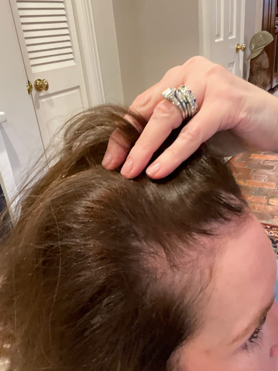 Customer photo — scalp at the part line during use